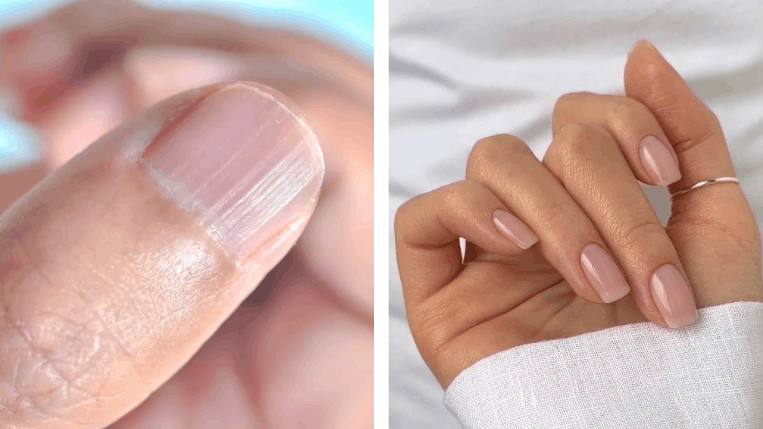 ongle striés